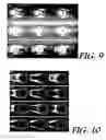Fig. 06 - Fluid separation