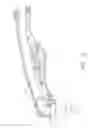 Fig. 03 - Dual mode plasma arc torch