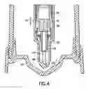Fig. 06 - Microdispensing pump