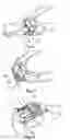 Fig. 03 - Self-help devie for handling socks, supporet stockings and stockings in general