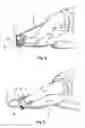 Fig. 04 - Self-help devie for handling socks, supporet stockings and stockings in general
