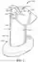 Fig. 02 - Noose lanyard with self-orienting mounting area