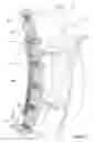 Fig. 03 - Valve seal and method of installing a valve seal