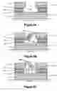 Fig. 06 - Coupled quantum well devices (CQWD) containing two or more direct selective contacts and methods of making same