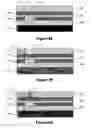 Fig. 12 - Coupled quantum well devices (CQWD) containing two or more direct selective contacts and methods of making same
