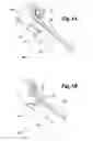 Fig. 04 - Vehicle front end suspension