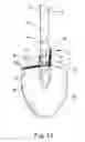 Fig. 18 - Tool