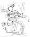 Fig. 04 - Juvenile high chair