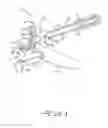 Fig. 02 - Semi-rigid anterior head alignment system