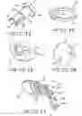 Fig. 06 - Semi-rigid anterior head alignment system