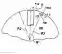Fig. 01 - Torque converter and system using the same