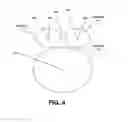 Fig. 06 - Tri-head KaKuKa feed for single-offset dish antenna