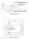 Fig. 11 - Liquid crystal display meter apparatus