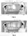 Fig. 09 - System  and method for magnifying and editing objects