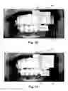 Fig. 10 - System  and method for magnifying and editing objects