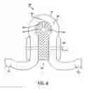 Fig. 06 - Drum maintenance system for an imaging device and method and system for maintaining an imaging device