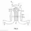 Fig. 06 - Drum maintenance system for an imaging device and method and system for maintaining an imaging device