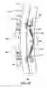 Fig. 09 - Apparatus and method for inspecting areas surrounding nuclear boiling water reactor core and annulus regions