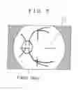 Fig. 06 - Fundus camera