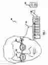 Fig. 02 - System, apparatus and method for correcting vision with an adaptive optic
