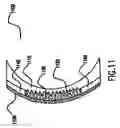 Fig. 09 - System, apparatus and method for correcting vision with an adaptive optic