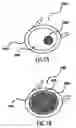 Fig. 12 - System, apparatus and method for correcting vision with an adaptive optic