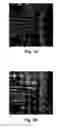 Fig. 04 - System and method for analysis and visualization of metamorphopsia through three dimensional scene regeneration and testing of vision thereby