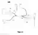 Fig. 16 - Laser digitizer system for dental applications