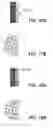 Fig. 14 - Tinted edge enhancement using look-up table edge pixel identification