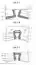 Fig. 09 - Perpendicular magnetic head with side shield depth less than write gap film