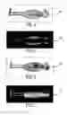 Fig. 04 - METHOD AND SYSTEM FOR RADIOGRAPHIC IMAGING WITH ORGAN-BASED RADIATION PROFILE PRESCRIPTION