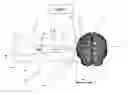 Fig. 06 - Analyzing radiological image using 3D stereo pairs