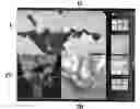 Fig. 01 - Method and system for computer aided detection of high contrast objects in tomographic pictures