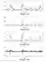 Fig. 11 - Method and apparatus for resolving individual signals in detector output data