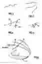 Fig. 03 - Device and method for superimposing patterns on images in real-time, particularly for guiding by localisation