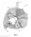 Fig. 04 - Hand-held body washing device