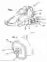 Fig. 02 - Quick gear changing engine hub assembly