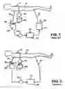 Fig. 02 - Extracorporeal blood circuit priming system and method