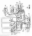 Fig. 04 - Extracorporeal blood circuit priming system and method