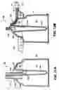 Fig. 11 - Extracorporeal blood circuit priming system and method
