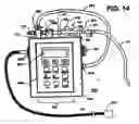 Fig. 15 - Extracorporeal blood circuit priming system and method