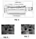 Fig. 05 - Optoelectronic system for particle detection
