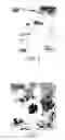 Fig. 03 - Fluorescent magnetic nanoparticles with specific targeting functions