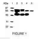 Fig. 02 - COMPOSITIONS AND METHODS TO ENHANCE VIABILITY AND FUNCTION OF ISLET CELLS