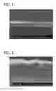 Fig. 02 - BIOPOLYMER MEMBRANE AND METHODS FOR ITS PREPARATION