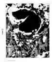 Fig. 03 - Use of ligands of specific antigen for the diagnosis and treatment of solid tumours and bone-related cancerous diseases