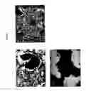 Fig. 11 - Use of ligands of specific antigen for the diagnosis and treatment of solid tumours and bone-related cancerous diseases