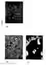 Fig. 14 - Use of ligands of specific antigen for the diagnosis and treatment of solid tumours and bone-related cancerous diseases