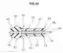 Fig. 16 - Gasket for electrolyte membrane