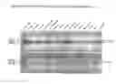Fig. 06 - LSAMP Gene Associated With Cardiovascular Disease